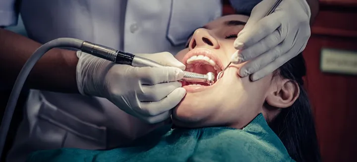 Kanal Tedavisi (Endodonti)